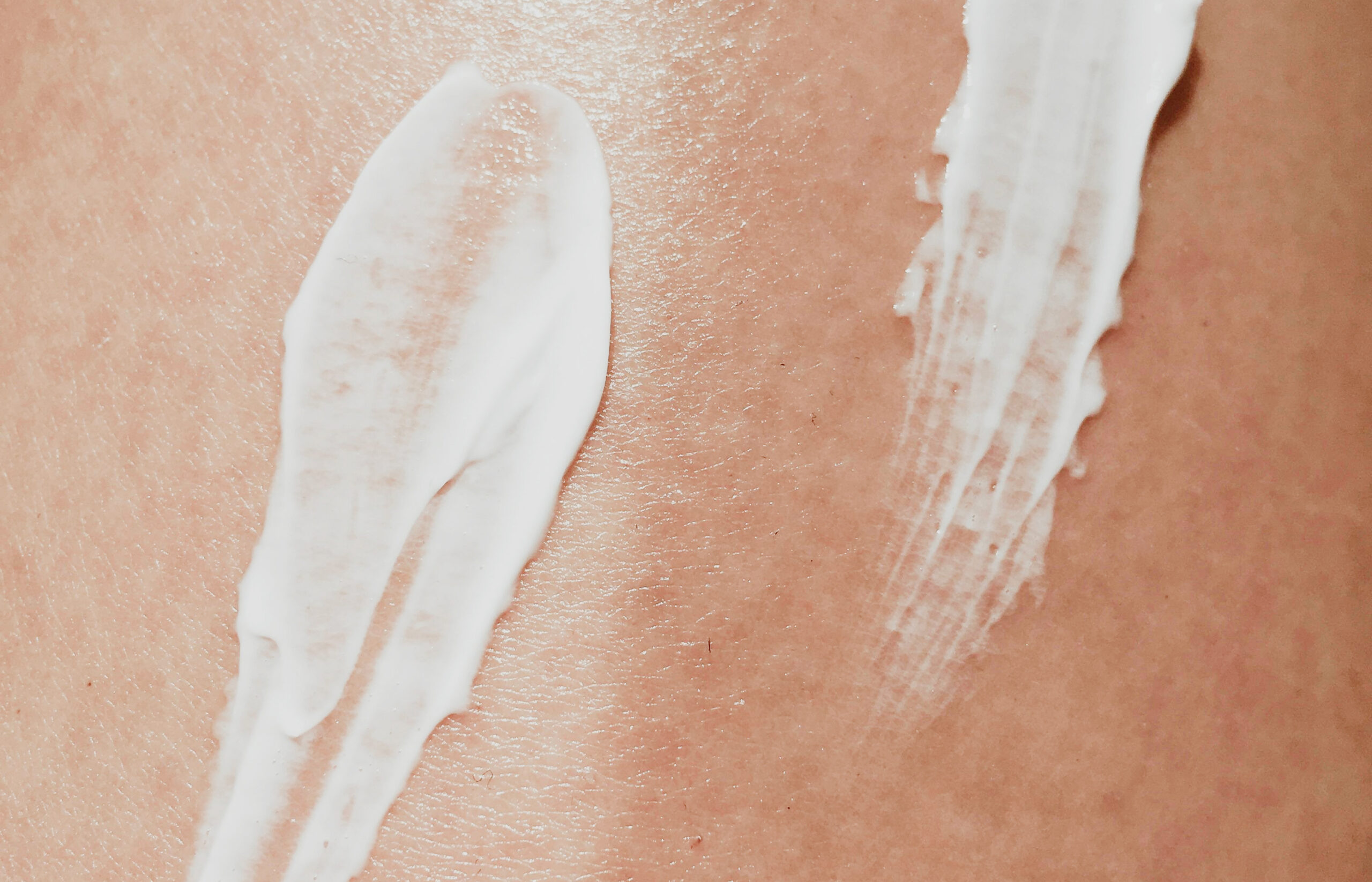 More than skin deep